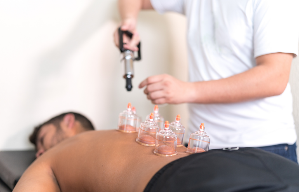 Cupping Τherapy